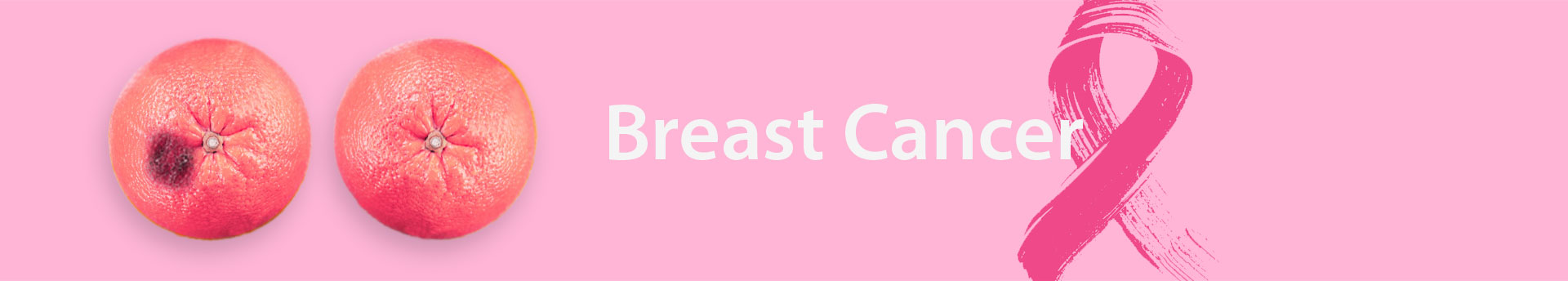 Medicaoncology Breast Cancer